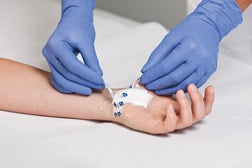Hydrofilm Plus Dressing