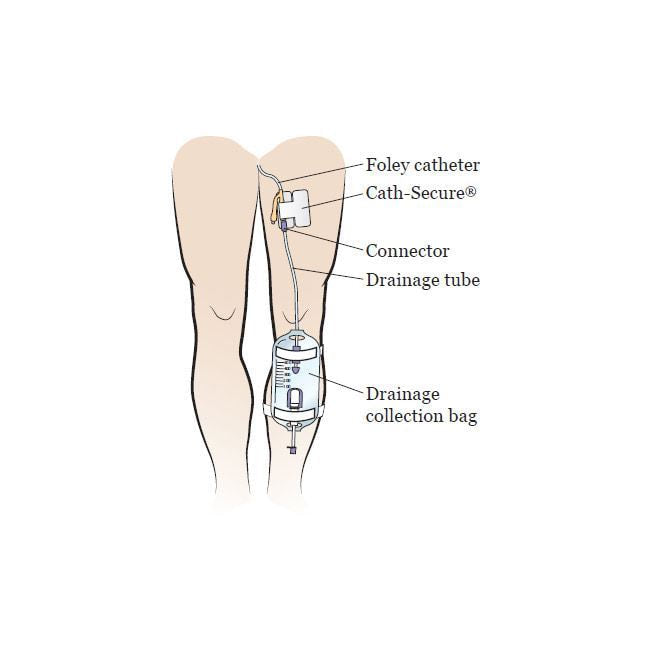 Cath-Secure Multipurpose Tube Holder