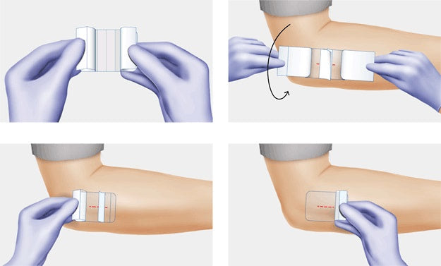 Hydrofilm Dressing
